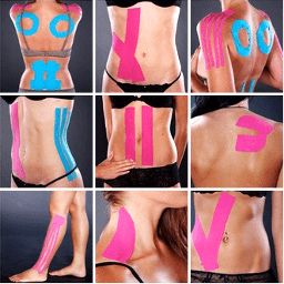 Kinesio Tape Behandlung